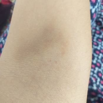 Iğdır Devlet Hastanesi Kan Alma Bölümü