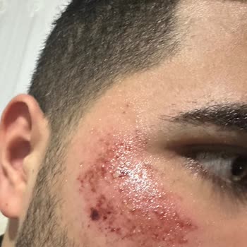 Dilan Polat Estetik Dikkat! Batman'daki Şubenizdeki İş Yerinin Sahibiyle Yaşadığım Sorunlar