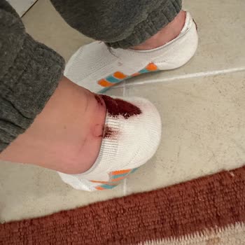 Urbanhub Sketchers Ayakkabı Şikayeti