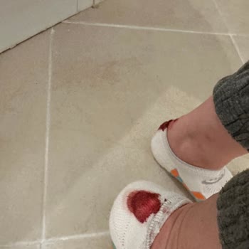 Urbanhub Sketchers Ayakkabı Şikayeti