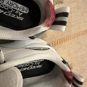 Urbanhub Sketchers Ayakkabı Şikayeti