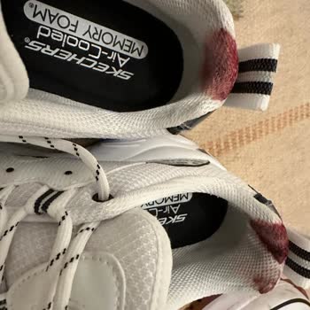 Urbanhub Sketchers Ayakkabı Şikayeti