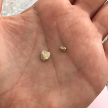 Makarna Lütfen Sarı Mercimek İçinden Taşlar Çıktı
