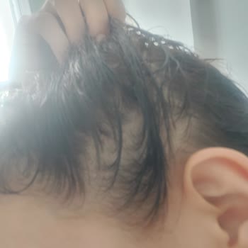 Yves Rocher Anti Chute Dökülme Karşıtı Serum Yerine Jöle Almışım