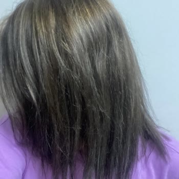 Sedat Akademi Business Saçlarımdaki Yeşillenme İçin Gittim Hem Param Hem Vaktim Gitti