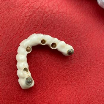 Sağlık Bakanlığı Diş Doktoru Mağduru