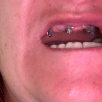 Sağlık Bakanlığı Diş Doktoru Mağduru