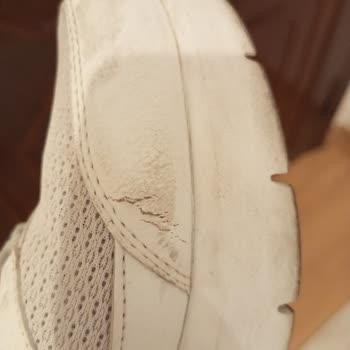 Skechers Marka Ayakkabımda Deri Soyulması