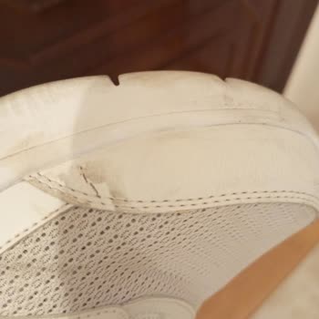 Skechers Marka Ayakkabımda Deri Soyulması