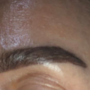 Suit Güzellik Merkezleri Kötü Yaptıkları İşlemin Arkasında Durmayıp Oyalama Yoluna Gidiyorlar