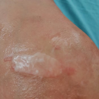 Nimet Gıda Böreğin Yağlı Olması