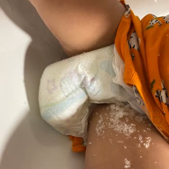 Molfix 4 Numara Bebek Bezi Bizi Mağdur Etti
