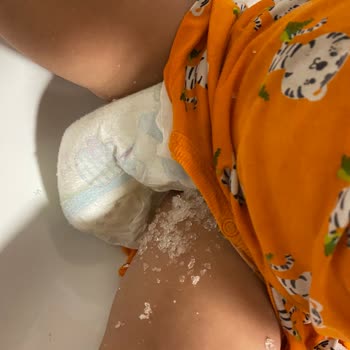 Molfix 4 Numara Bebek Bezi Bizi Mağdur Etti