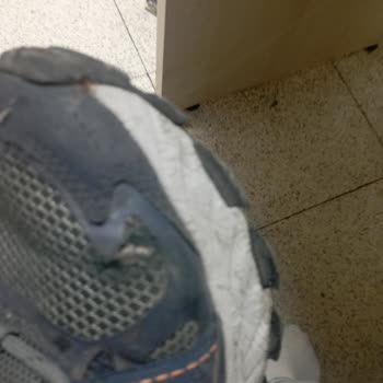 Skechers Ayakkabı Yırtılma Ve Garanti Süreci