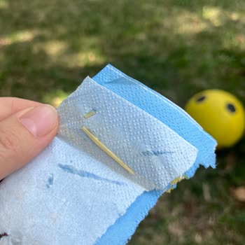 Bahçelievler Devlet Hastanesi Bir Şey Yok Denilen Yerden Çıkan Kıymık