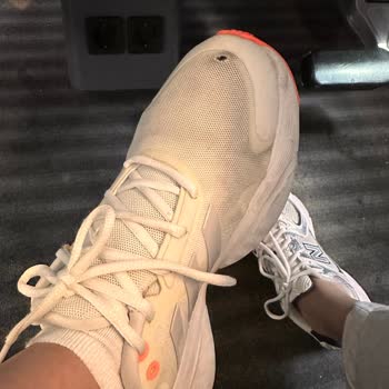Adidas Spor Ayakkabı Kalitesizliği
