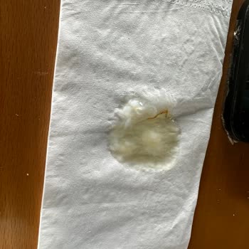 Beltur Hızlı Kahvaltı Daki Yumurta Çığ Geldi
