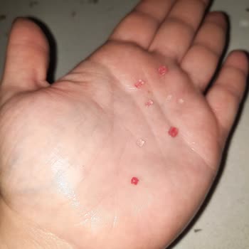 Trendyol Childgen Oyun Hamurundan Çıkan Sert Maddeler