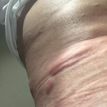 Groupama Sigorta Acil Teminatım Olduğu Halde Ödeme Yapmadı