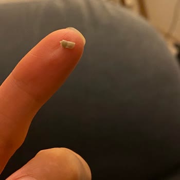 Sarelle Fındık Ezmesinin İçinden Lastik Parçası Çıktı