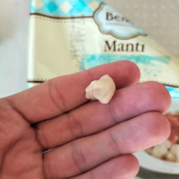 A101 Mantı İçinden Kıl Çıktı