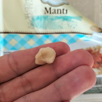 A101 Mantı İçinden Kıl Çıktı