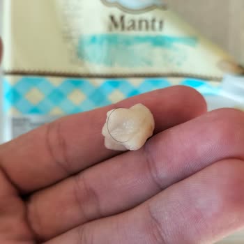 A101 Mantı İçinden Kıl Çıktı