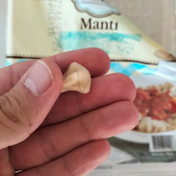 A101 Mantı İçinden Kıl Çıktı