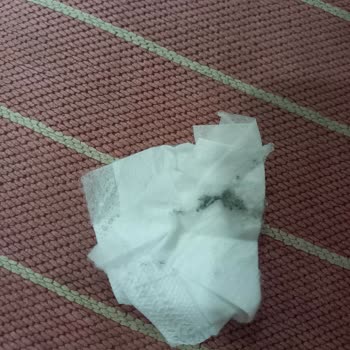 Baby & Me Bebek Bezinin İçinden Yabancı Bir Madde Çıktı