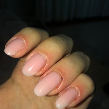 Natural Nail House Tırnak Etlerim Kan İçinde Ve Şiştiler