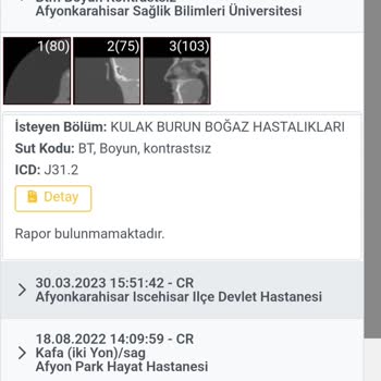 Afyonkarahisar Sağlık Bilimleri Üniversitesi Hastanesi (AFSÜ Hastanesi) 1 Aydır Çıkmayan Tomografi Raporu