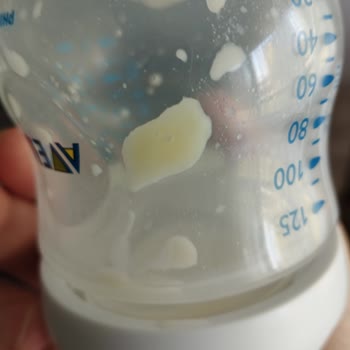 Sma Mama Topaklanması