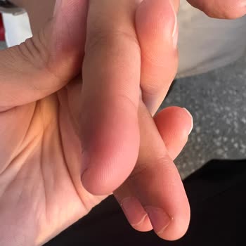 Haribo Chammalows Rubino Ürünü Alerjik Reaksiyona Sebep Oldu