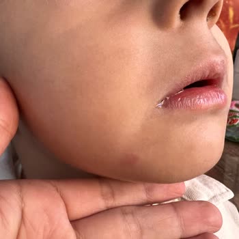 Haribo Chammalows Rubino Ürünü Alerjik Reaksiyona Sebep Oldu