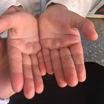 Haribo Chammalows Rubino Ürünü Alerjik Reaksiyona Sebep Oldu