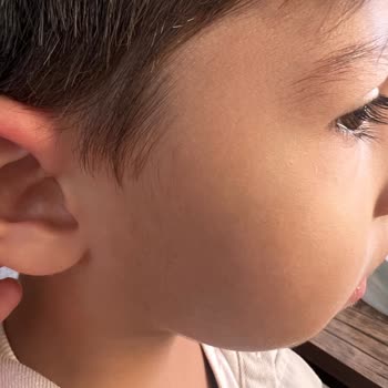 Haribo Chammalows Rubino Ürünü Alerjik Reaksiyona Sebep Oldu