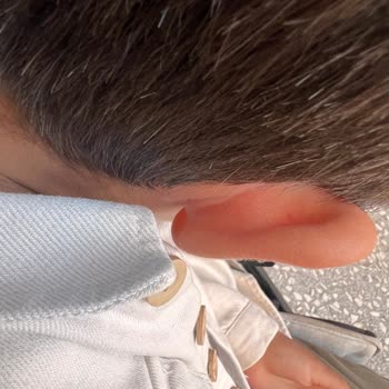 Haribo Chammalows Rubino Ürünü Alerjik Reaksiyona Sebep Oldu