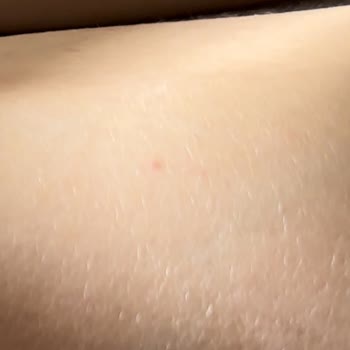 City Clinic Seans Sonuçları Hijyen Ve Randevu Sistemi