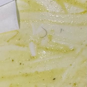 Tavuk Dünyası Tabağımdan Kıl Çıktı