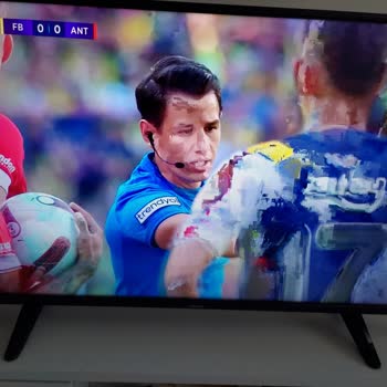 Digiturk Todtv Piksel Sorunu
