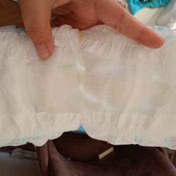 Molfix Bebek Bezinin Sızdırması