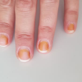 Flormar Bayrak Kırmızı Oje Tırnakta Sarı Turuncu Renk Bırakıyor