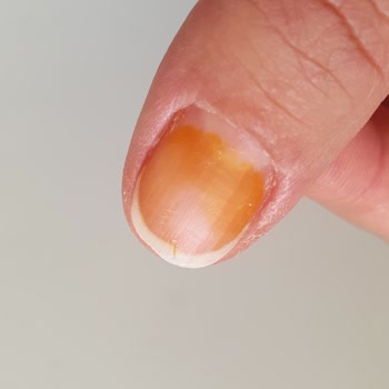 Flormar Bayrak Kırmızı Oje Tırnakta Sarı Turuncu Renk Bırakıyor