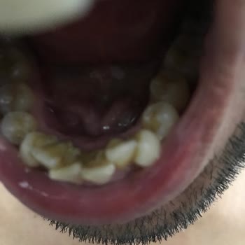 Şok Market Deren İce Tea Skandalı