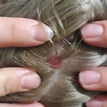 Palette Yüzünden Kafa Derim Yandı