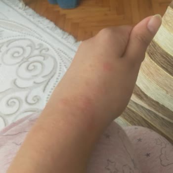 Maybelline New York Ruju Alerji Yaptı