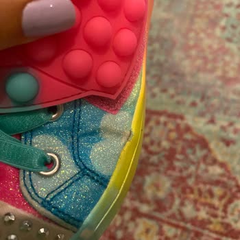 Skechers Ayakkabı Kalitesizliği