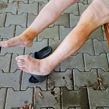 Ortanca Belediyesi Sarıgerme Tahta Plaj Yolu Çok Kötü