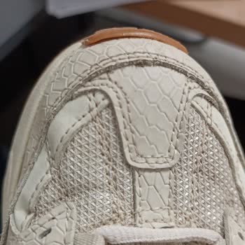 Skechers Marka Ayakkabının Açılma Yapması ve Kullanıcı Hatası Denmesi