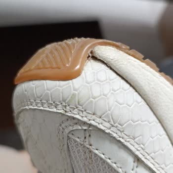 Skechers Marka Ayakkabının Açılma Yapması ve Kullanıcı Hatası Denmesi